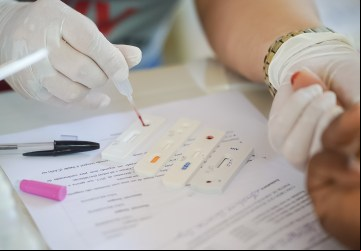 Testagens rápidas de Infecções Sexualmente Transmissíveis (ISTs) serão um dos serviços de saúde oferecidos pelo Governo de Goiás durante campanha Novembro Azul