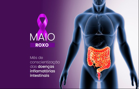 Doenças inflamatórias intestinais são destaque neste Maio Roxo